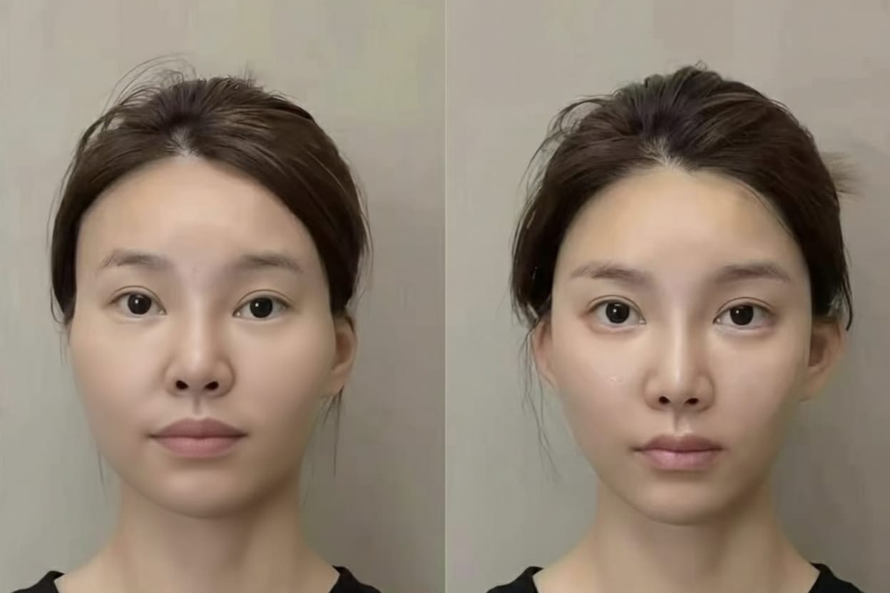 Tone & Firmness before