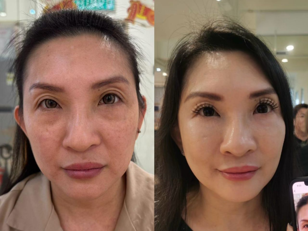 Vyvyan Lim · Full Transformation before